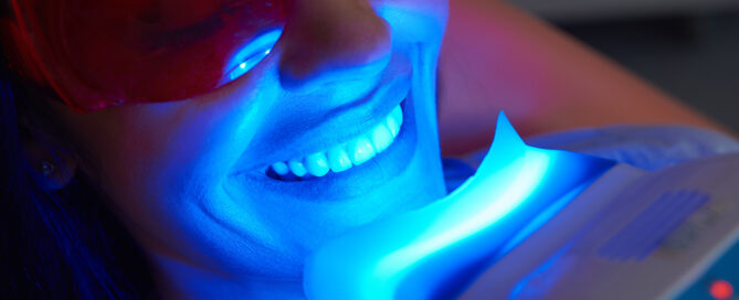 Unlocking Your Brightest Smile: Teeth Whitening Options