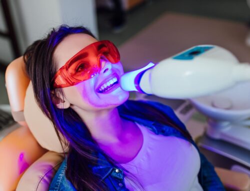 Unveiling the Truth: Professional vs. DIY Teeth Whitening